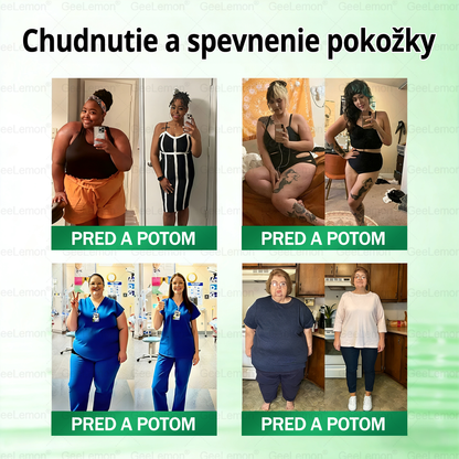 👉 Oficiálna certifikácia 🔥 Tisíce spokojných zákazníkov na Slovensku| ❤️ 𝐆𝐞𝑒𝐿𝑒𝐦𝐨𝐧® Glumasetide 10 v 1 Nano mikrotŕňový náplasť – Len raz denne ✅ Viditeľné zmeny za 7 dní na obezitu, ochabnutú pokožku a zdravie