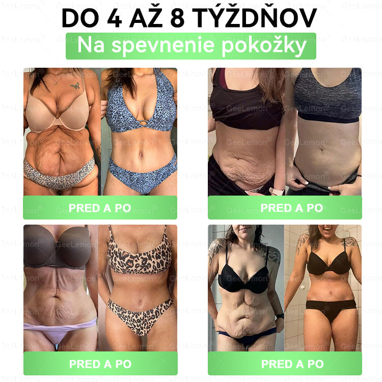 👉 Oficiálna certifikácia 🔥 Tisíce spokojných zákazníkov na Slovensku| ❤️ 𝐆𝐞𝑒𝐿𝑒𝐦𝐨𝐧® Glumasetide 10 v 1 Nano mikrotŕňový náplasť – Len raz denne ✅ Viditeľné zmeny za 7 dní na obezitu, ochabnutú pokožku a zdravie