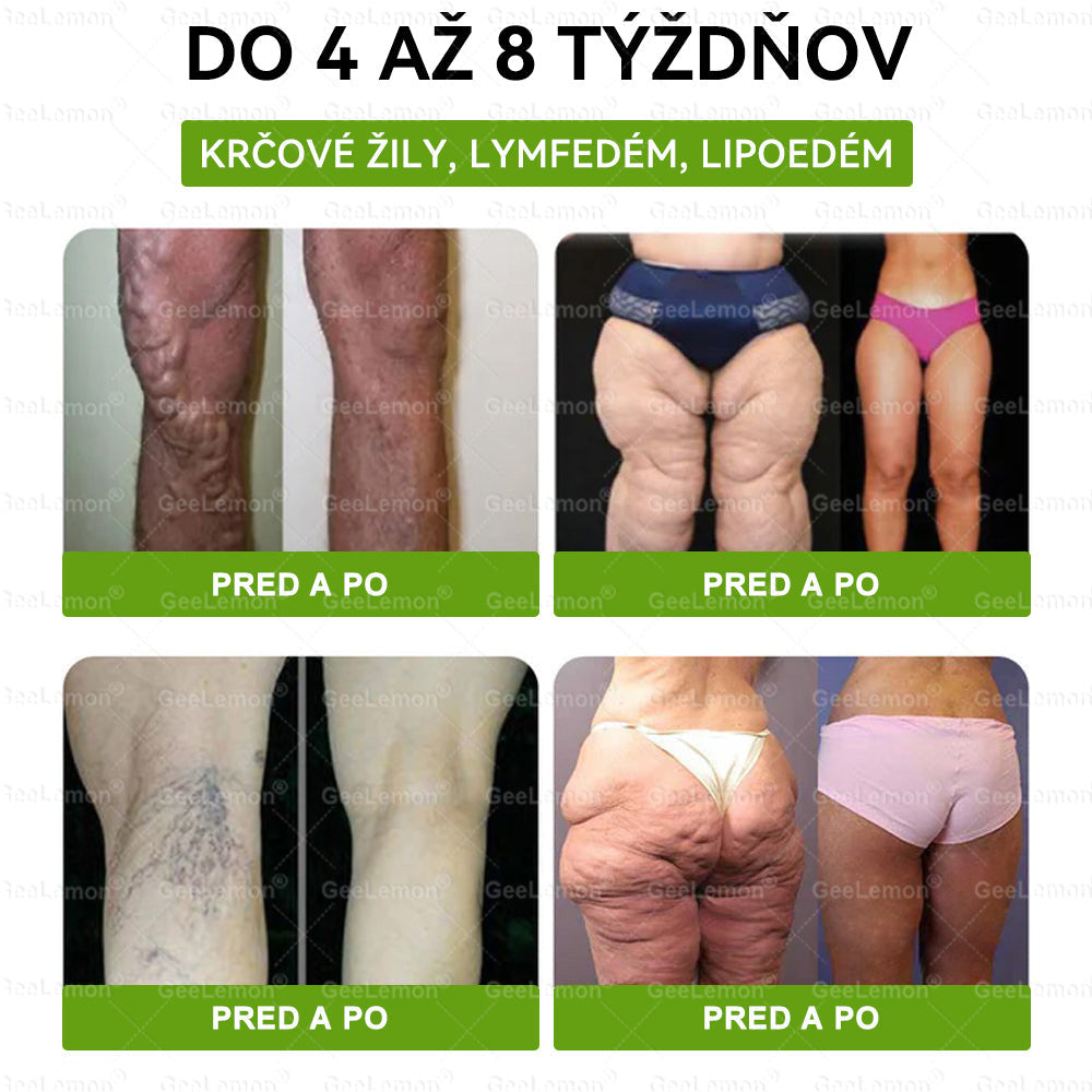 TÁTO PONUKA NEČAKÁ ⏳ TERAZ ZĽAVA −50 % 🔥 ZÁSOBY SA RÝCHLO ZMENŠUJÚ ODOČÍTAVANIE BEŽÍ KTO VÁHA, ZAPLATÍ VIAC ❌ KONAJTE HNEĎ